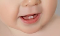 Bebeğinizin rahat diş çıkarması için yapmanız gerekenler 