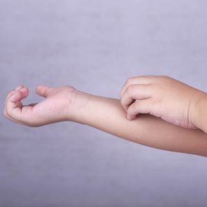 Çocuklarda egzamaya dikkat!