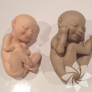 Ultrason görüntüsünden 3 boyutlu bebekler