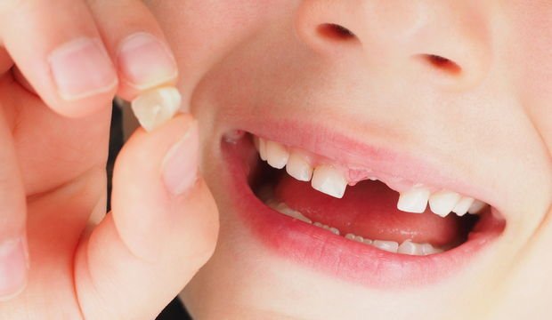 Çocuklarda diş sorunlarına ilk yardım önerileri